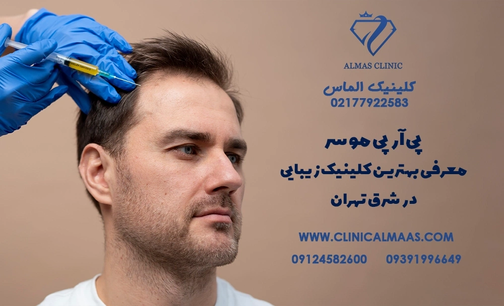 پی آر پی مو سر | معرفی بهترین کلینیک زیبایی در شرق تهران